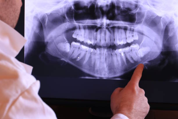 Best Mobile Emergency Dentist in Palm Beach Shores, FL